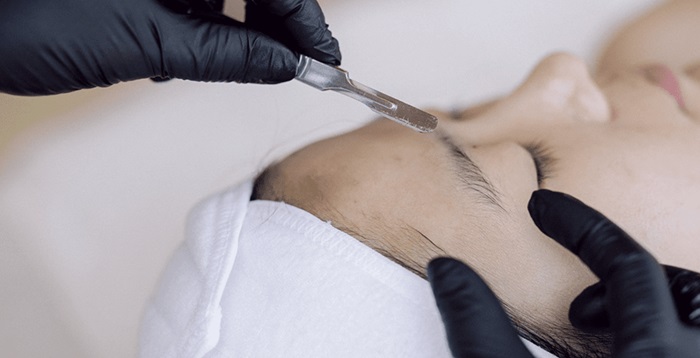 Dermaplane Treatment Dermaplane Treatment