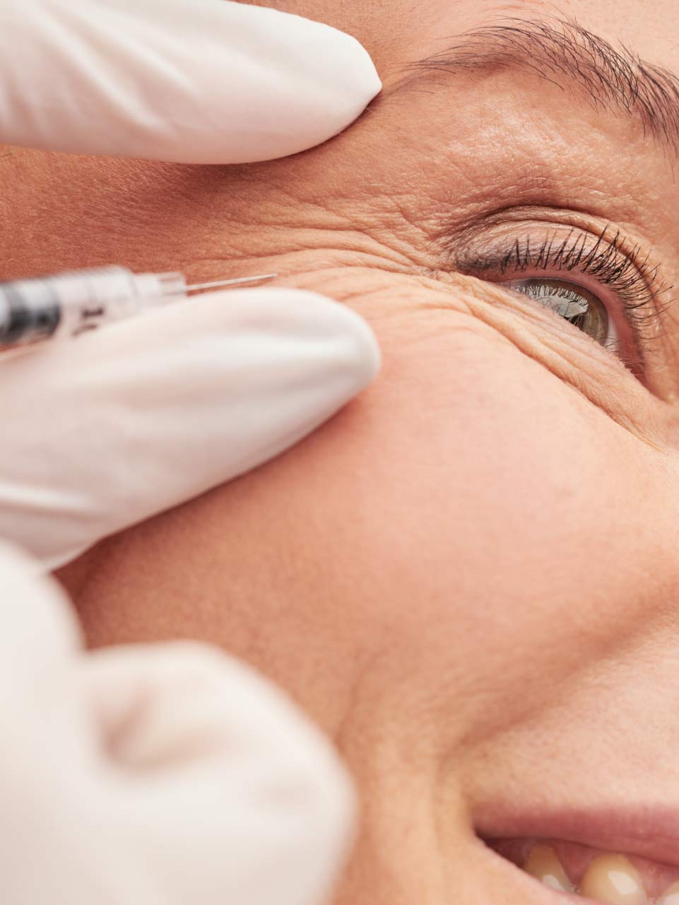 Injectables