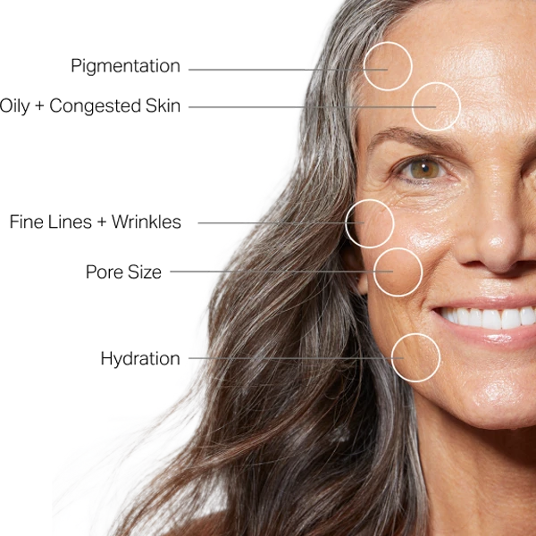Hydrafacial treatment in Maryland